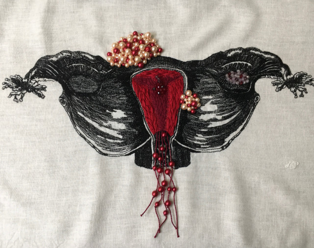 Bleeding Vessel (2022). An embroidery of a uterus, including Fallopian tubes and ovaries, stitched in black thread on white linen textured like a woodcut. Inside the uterus, the endometrium is thickly stitched in bright red and burgundy. There is a large fibroid on the top of the uterus and a smaller fibroid on the right lower side, both beaded in red, pink, and cream beads. A cyst on the right ovary is beaded in clear, purple, and red beads, and a small section of dark red and purple beads is a polyp inside the uterus. Long burgundy strings hang from the bottom of the uterus with red beads on them that extend past the vaginal opening. 