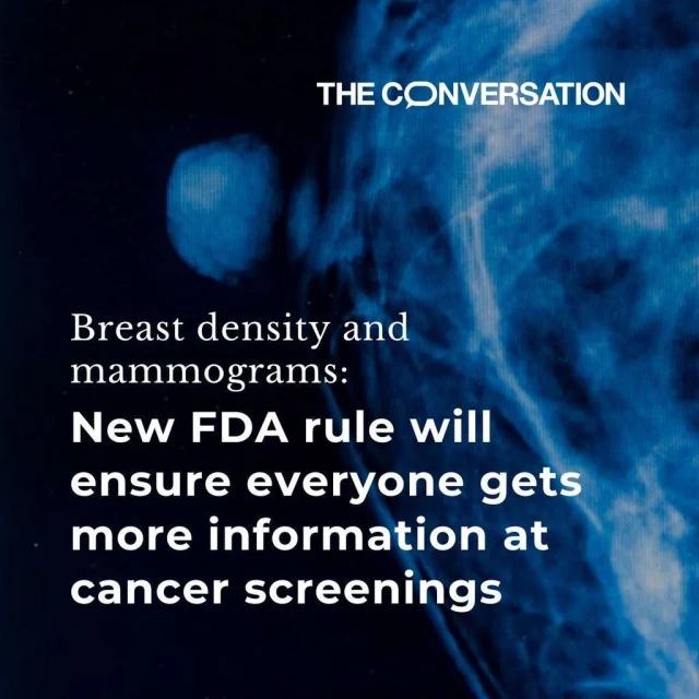 A mammogram. The graphic reads "Breast density and mammograms: New FDA rule will ensure everyone gets more information at cancer screenings".