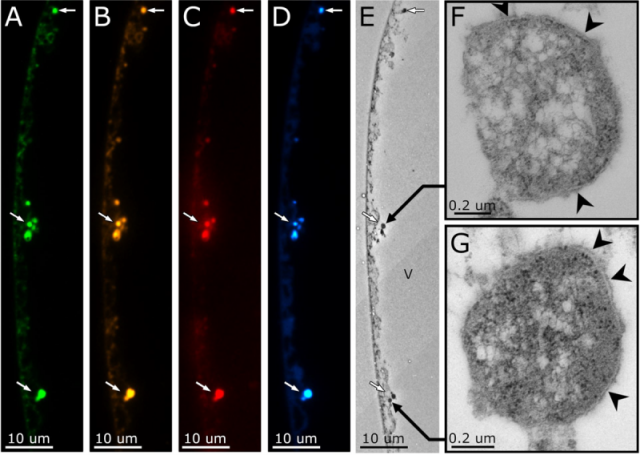 Characterization of the pepin organelles by FISH and correlative TEM as well as membrane and DNA staining. A─D: Pepins (arrows) in the cytoplasm of "Ca. T. magnifica" (class Gammapro­teo­­bacteria) are labeled with the gene­ral bacterial probe EUB labeled with Alexa Fluor 488 (A, green), Gamma­pro­teo­bac­teria specific 5 probe Gam42a labeled with Cy3 (B, yellow), Thiomar­garita-spe­cific probe Thm482 labeled with Cy5 (C, red) and with DAPI (D, blue). E TEM of a serial thin section con­secutive to the semi-thin section used for FISH. The FISH and DAPI positive pe­pins appear as elec­tron dense organ­elles under TEM. F,G Pepins (from E) under higher magni­fi­cation; pepins are delimited by a mem­brane (arrowheads) and contain numer­ous ribosomes which appear as small electron dense gran­ules. Source https://www.biorxiv.org/content/10.1101/2022.01.26.477692v1