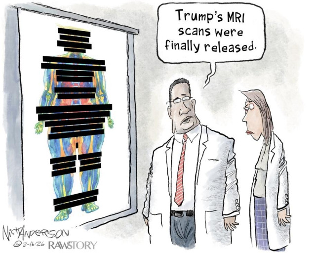 Cartoon commentary by Nick Anderson on Trump and Pam Bondi's cover-up of the Epstein files, showing an MRI scan of Trump with extensive redactions