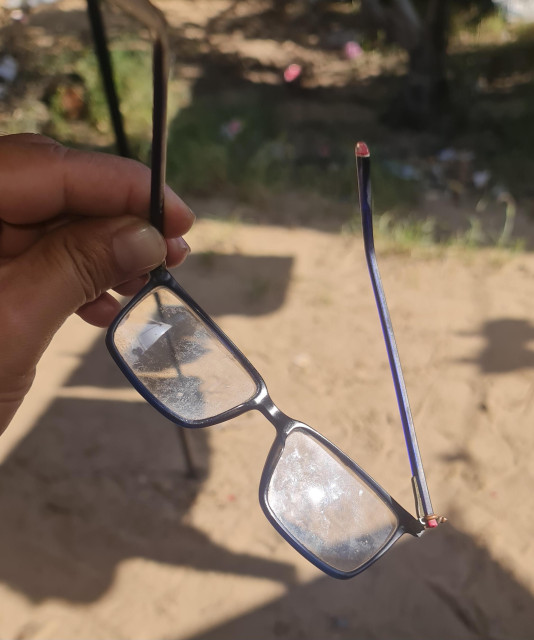 I feel ashamed to ask, but I urgently need help.
I suffer from severe vision problems and cannot live or function without prescription glasses.
My current pair is more than 3 years old, broken, and has over 1000 scratches, which greatly affects my eyesight.
I urgently need a new pair of glasses.
The cost is €150.
Any support would mean a lot to me.
https://chuffed.org/project/144437
#gaza #palestine #glasses