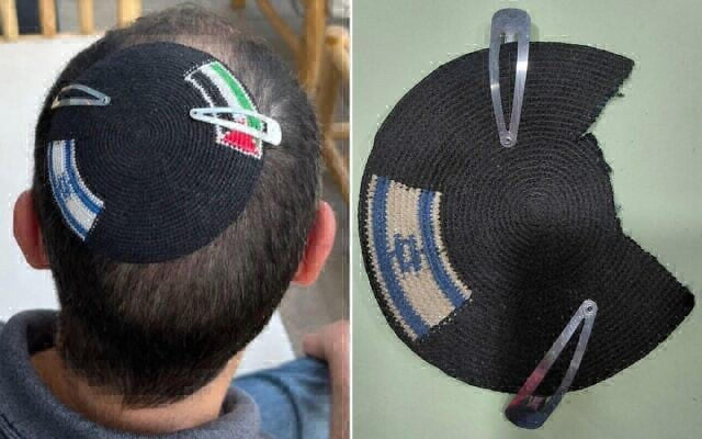 Alex Sinclair's kippa before and the mutilated kippa with the Palestinian flag removed after being detained