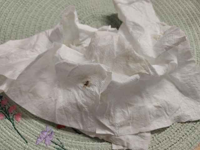 Picture of dirty tissue paper showing a darker brown stain and general yellowing.