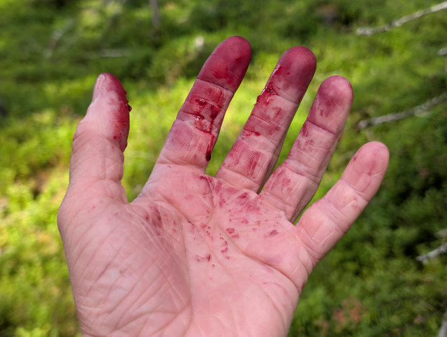 A proto of a hand with red stained fingers and something red running down several fingers. The background is an out of focus, sunlit patch of greenery.